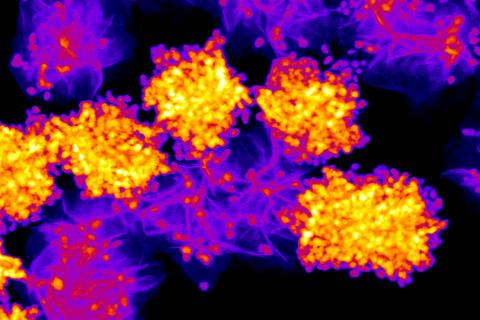 Electron microscope image showing preferential deposition of gold nanoparticles onto transition metal ditellurides