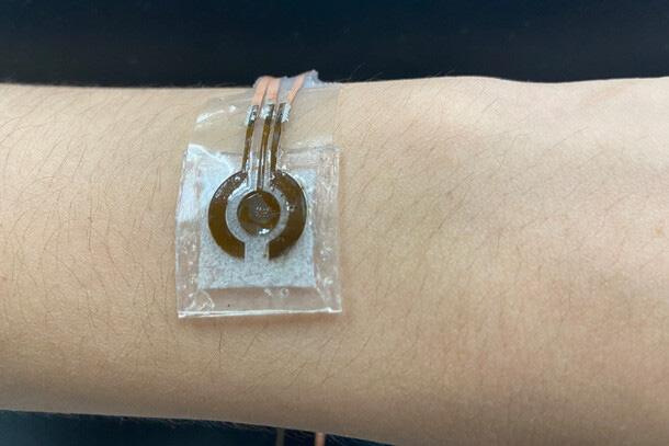 Penn State researchers developed a prototype of a wearable, noninvasive glucose sensor, shown here on the arm