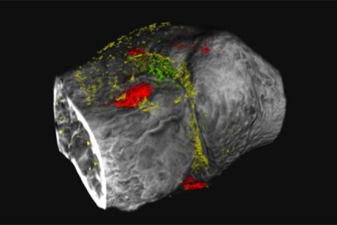 technicolor imaging of degenerative joint disease