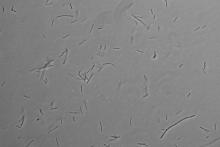 Thermus scotoductus cells