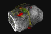 technicolor imaging of degenerative joint disease